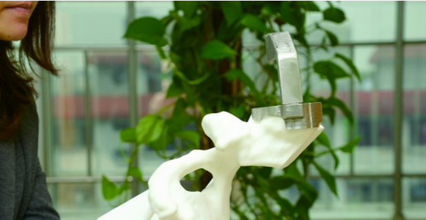 3D打印已成为骨科医生的好帮手