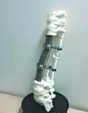 2022年3D打印医疗市场规模有望破260亿