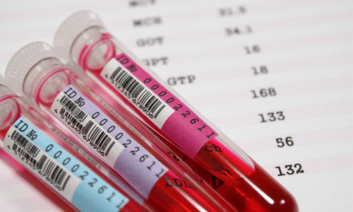 人造血液研究将迎来数十年首个突破