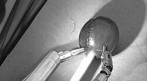 未来达芬奇手术机器人的应用将更为广阔