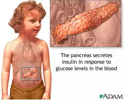 Bart Roep博士利用造血干细胞移植治疗I型糖尿病
