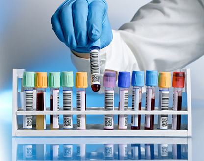 IVD五大版块解析:生化、免疫、血球、分子和POCT