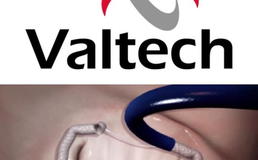 医疗设备公司Edwards再投6.9亿美元入局心脏瓣膜经导管领域