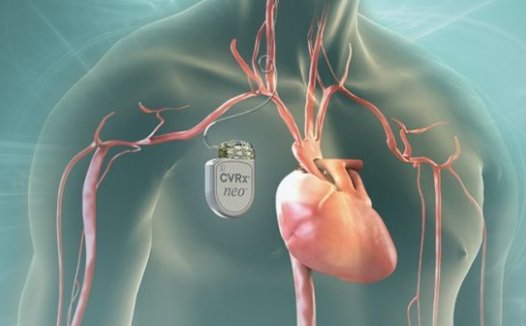 可植入医疗设备可监测病情:推动医疗技术发展