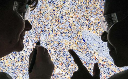 智能医疗设备公司3Scan获1400万美元B轮融资:开发机器人显微镜