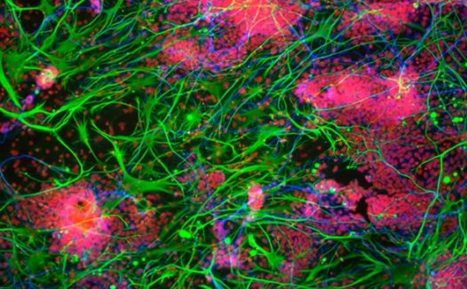 日本完成首例再编程干细胞异体移植手术