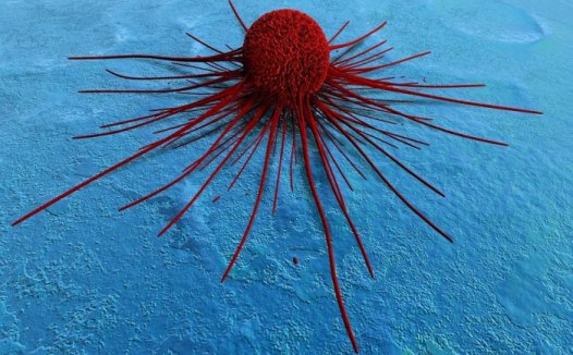 上海中科院发现肺转移性乳腺癌干细胞