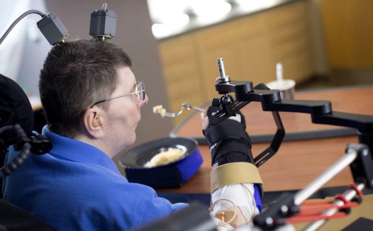 瘫痪者仅靠意识就能控制四肢了