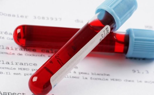 加州大学发现用一管血就能检测癌症