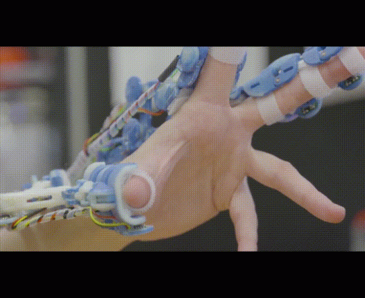 这款可穿戴微创手术机器人能超越达芬奇机器人吗？