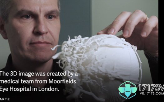 借助虚拟现实眼镜可看清眼球血管