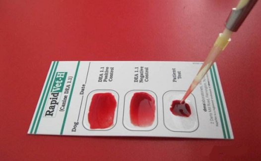 借助人工智能30秒内鉴定血型:准确率超99.9%