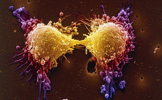 Science:双靶向抗体CT16靶向肿瘤干细胞