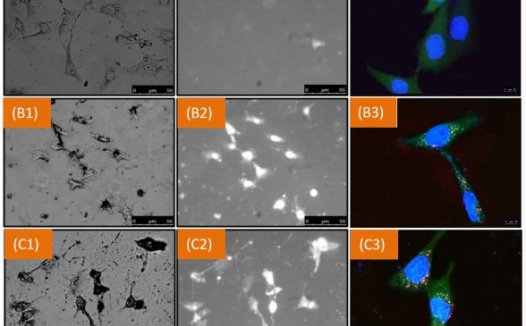 俄科学家在超声帮助下找到并杀伤癌细胞