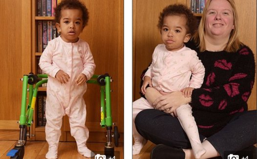 英国2岁神经纤维瘤患儿因MEK抑制剂获生命奇迹