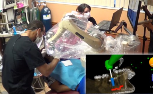 首个牙科机器人导航系统Yomi获得FDA批准