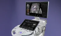 GE彩超 新品Voluson Expert 22最近发布